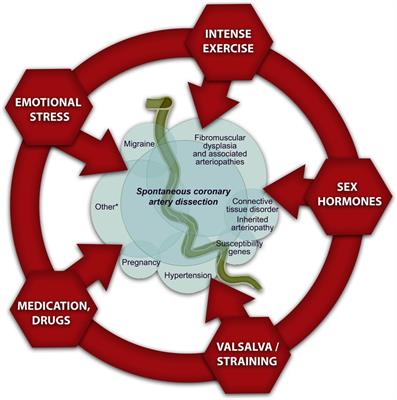 A review of the risk and precipitating factors for spontaneous coronary artery dissection